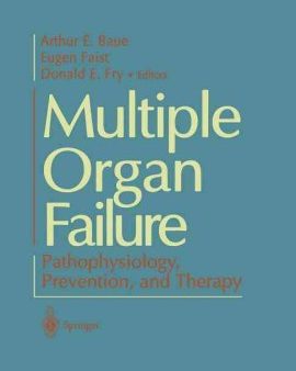 Multiple Organ Failure on Sale